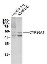 CYP26A1 Recombinant Rabbit Monoclonal Antibody