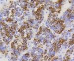 TOMM20 Antibody in Immunohistochemistry (Paraffin) (IHC (P))