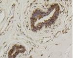 HSPA1B Antibody in Immunohistochemistry (Paraffin) (IHC (P))