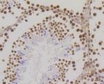H3K18me1 Antibody in Immunohistochemistry (Paraffin) (IHC (P))