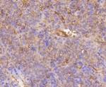 ITGB1 Antibody in Immunohistochemistry (Paraffin) (IHC (P))