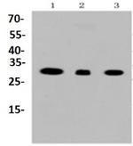 VDAC1 Antibody in Western Blot (WB)