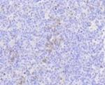 MLKL Recombinant Rabbit Monoclonal Antibody