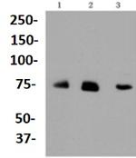 ALAS1 Antibody in Western Blot (WB)