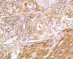 FLNA Antibody in Immunohistochemistry (Paraffin) (IHC (P))