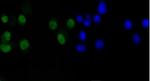 CCND1 Recombinant Rabbit Monoclonal Antibody