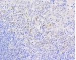CCND1 Antibody in Immunohistochemistry (Paraffin) (IHC (P))