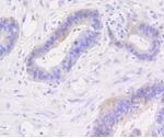 CTNNB1 Antibody in Immunohistochemistry (Paraffin) (IHC (P))