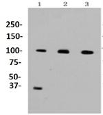 CTNNB1 Antibody in Western Blot (WB)