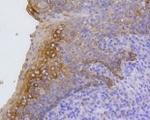 KRT17 Antibody in Immunohistochemistry (Paraffin) (IHC (P))