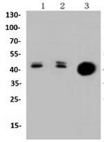 KRT20 Antibody in Western Blot (WB)