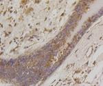 BAD Antibody in Immunohistochemistry (Paraffin) (IHC (P))