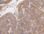 ITGB1 Antibody in Immunohistochemistry (Paraffin) (IHC (P))