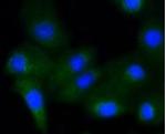 Phospho-GYS1 (Ser641) Recombinant Rabbit Monoclonal Antibody