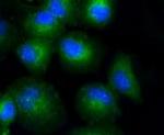 COL17A1 Recombinant Rabbit Monoclonal Antibody