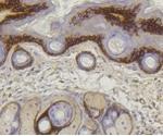 COL17A1 Antibody in Immunohistochemistry (Paraffin) (IHC (P))