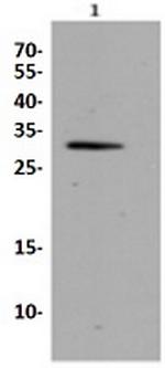 CDK5 Antibody in Western Blot (WB)
