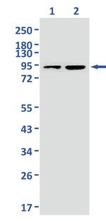 DLG4 Recombinant Rabbit Monoclonal Antibody