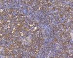 CCR7 Antibody in Immunohistochemistry (Paraffin) (IHC (P))