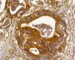RHOC Antibody in Immunohistochemistry (Paraffin) (IHC (P))