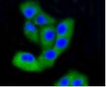 PTK2 Recombinant Rabbit Monoclonal Antibody