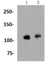 PTK2 Antibody in Western Blot (WB)