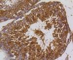PIK3R3 Antibody in Immunohistochemistry (Paraffin) (IHC (P))