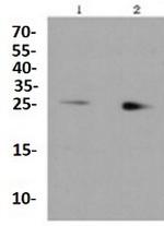 RAB9A Antibody in Western Blot (WB)