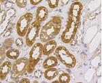 MAP2K2 Antibody in Immunohistochemistry (Paraffin) (IHC (P))