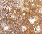 CASP2 Antibody in Immunohistochemistry (Paraffin) (IHC (P))