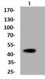 CASP2 Antibody in Western Blot (WB)