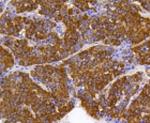PHB1 Antibody in Immunohistochemistry (Paraffin) (IHC (P))