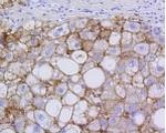 SCARB1 Antibody in Immunohistochemistry (Paraffin) (IHC (P))