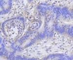 H2AK9ac Antibody in Immunohistochemistry (Paraffin) (IHC (P))