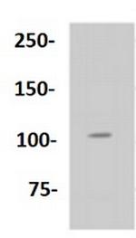 Phospho-RB1 (Ser807) Antibody in Western Blot (WB)