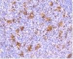 IFNAR1 Recombinant Rabbit Monoclonal Antibody