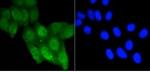 Acetyl-TP53 (Lys370) Recombinant Rabbit Monoclonal Antibody