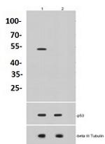 Acetyl-TP53 (Lys370) Antibody in Western Blot (WB)