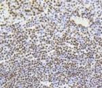H4K5ac Antibody in Immunohistochemistry (Paraffin) (IHC (P))