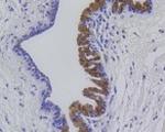 MMP12 Recombinant Rabbit Monoclonal Antibody