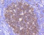 CDK2 Antibody in Immunohistochemistry (Paraffin) (IHC (P))