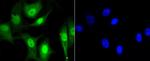 CBX5 Recombinant Rabbit Monoclonal Antibody