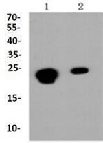 CBX5 Antibody in Western Blot (WB)