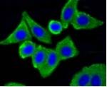 CAV1 Recombinant Rabbit Monoclonal Antibody
