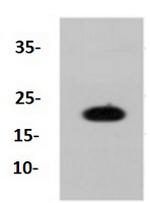 CAV1 Antibody in Western Blot (WB)