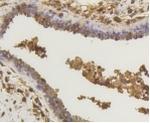 RELA Antibody in Immunohistochemistry (Paraffin) (IHC (P))