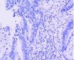 ERG Antibody in Immunohistochemistry (Paraffin) (IHC (P))