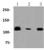 RNF20 Recombinant Rabbit Monoclonal Antibody