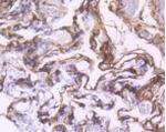 PDGFRB Recombinant Rabbit Monoclonal Antibody