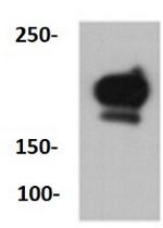 PDGFRB Antibody in Western Blot (WB)